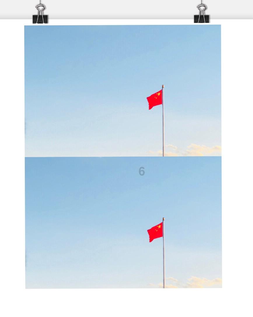 胸主动脉瘤的手术指征有哪些，怎么判断？游戏画面